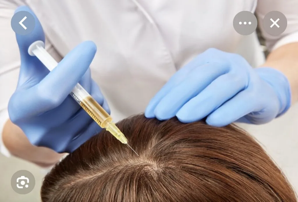 PRP therapy for hair at PROGEN