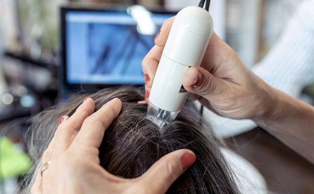 MFU Hair Restoration