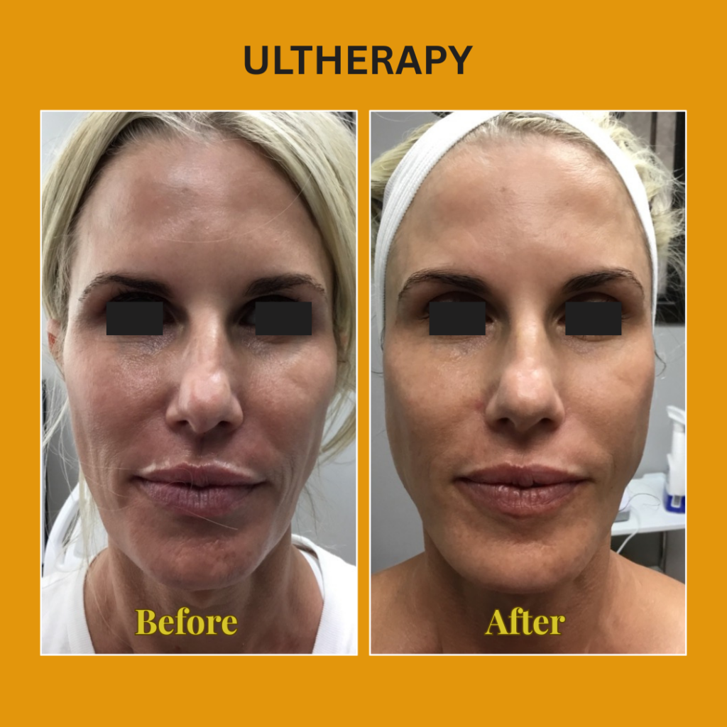 7FB075D1-25A3-42D4-BBE6-845C1BADA002