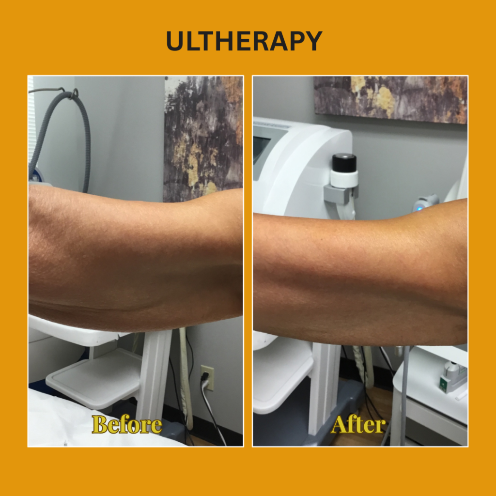 86B4F6F0-18F4-4787-96FB-B04965FCA4F7